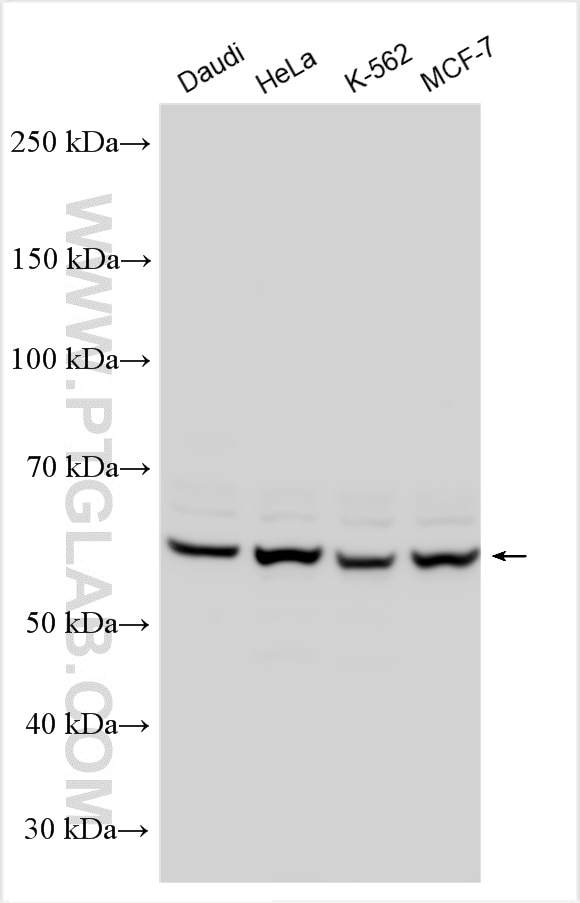 Western Blot (WB) analysis of various lysates using Twinkle/PEO1 Polyclonal antibody (18793-1-AP)