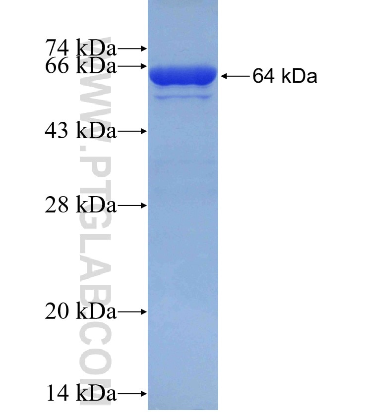 PEO1 fusion protein Ag4239 SDS-PAGE