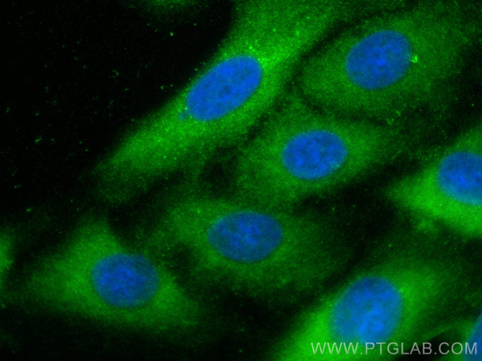 Immunofluorescence (IF) / fluorescent staining of A549 cells using PEPD Polyclonal antibody (12218-1-AP)