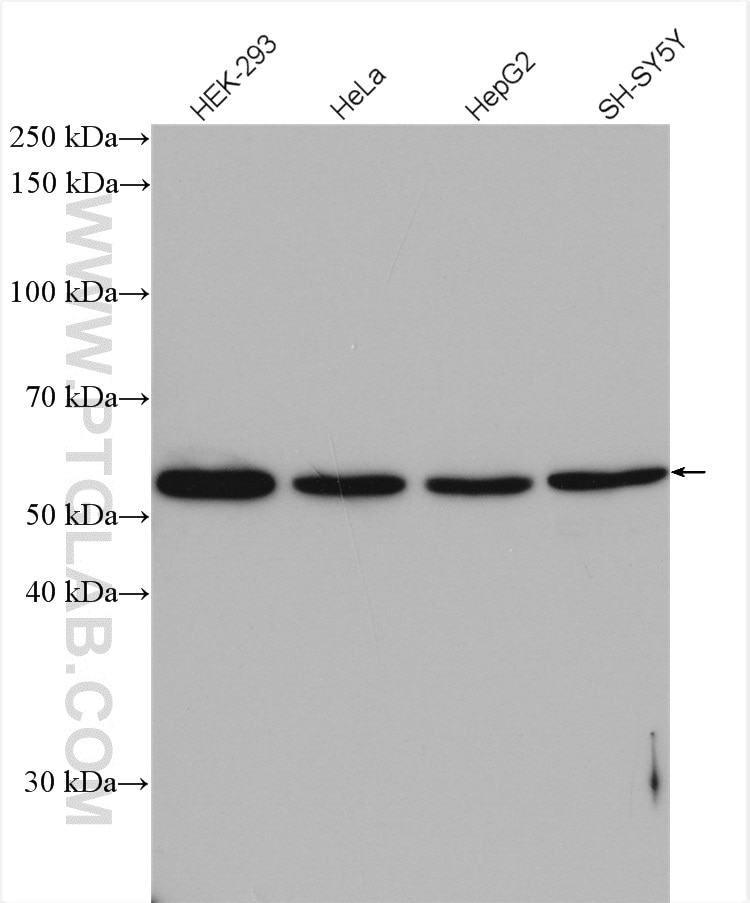 WB analysis using 12218-1-AP