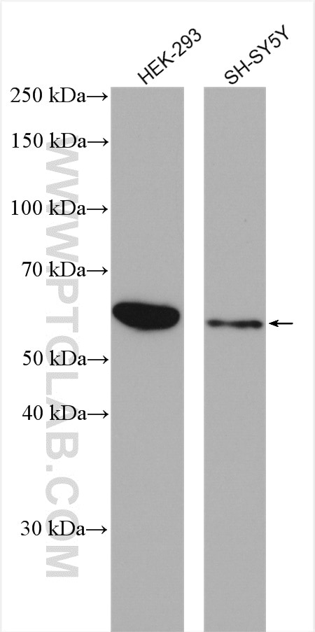 Western Blot (WB) analysis of various lysates using PEPD Polyclonal antibody (12218-1-AP)