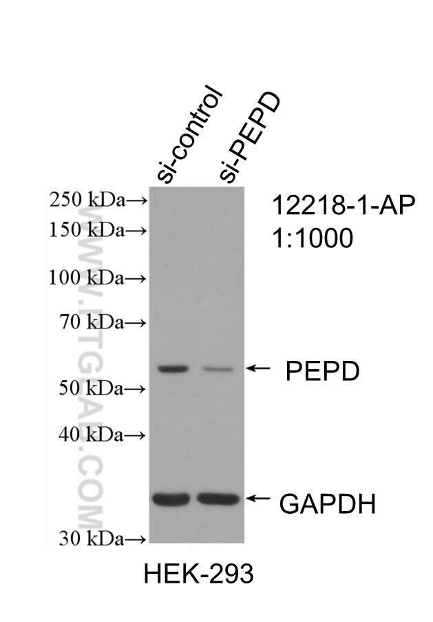 Western Blot (WB) analysis of HEK-293 cells using PEPD Polyclonal antibody (12218-1-AP)