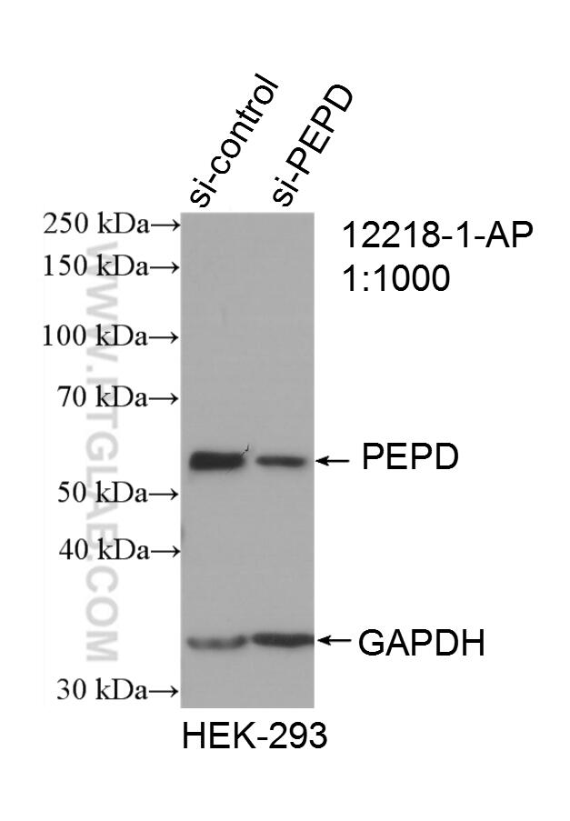 Western Blot (WB) analysis of HEK-293 cells using PEPD Polyclonal antibody (12218-1-AP)