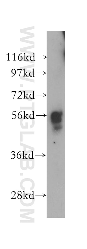 Western Blot (WB) analysis of mouse skin tissue using PEPD Polyclonal antibody (12218-1-AP)