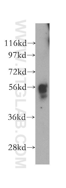 WB analysis of mouse skin using 12218-1-AP