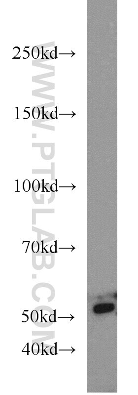 WB analysis of HeLa using 12218-1-AP