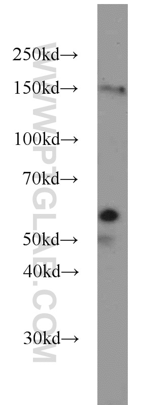 Western Blot (WB) analysis of HepG2 cells using PEPD Polyclonal antibody (12218-1-AP)