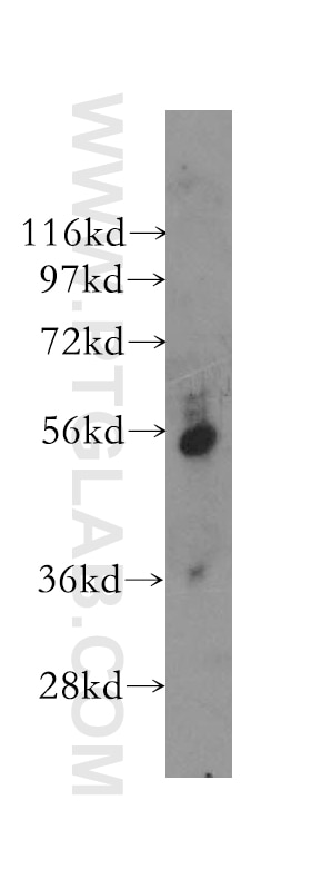 Western Blot (WB) analysis of MDA-MB-453s cells using PEPD Polyclonal antibody (12218-1-AP)