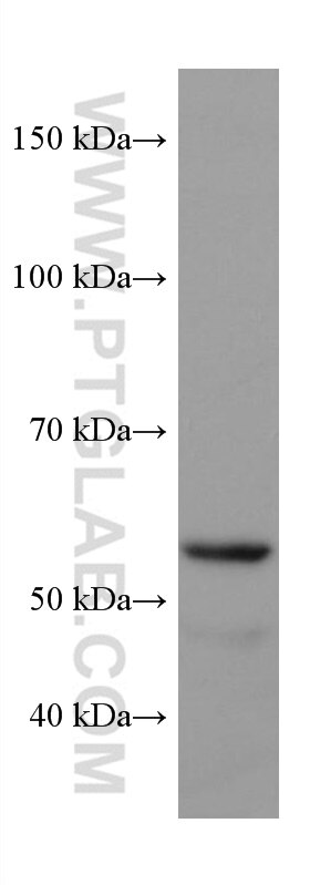 Western Blot (WB) analysis of NCCIT cells using PEPD Monoclonal antibody (67202-1-Ig)