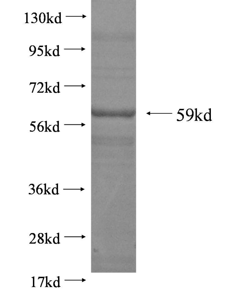 PEPD fusion protein Ag2842 SDS-PAGE