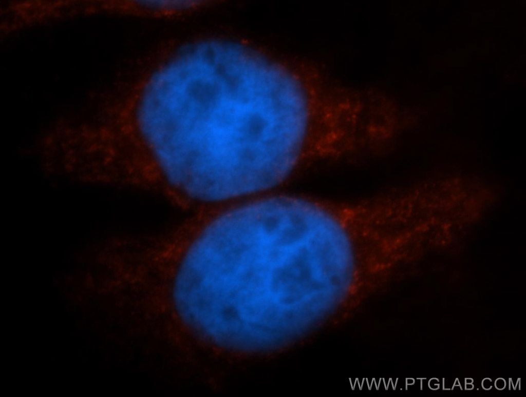 Immunofluorescence (IF) / fluorescent staining of HeLa cells using PER1 Polyclonal antibody (13463-1-AP)
