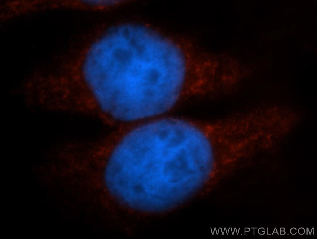 IF Staining of HeLa using 13463-1-AP