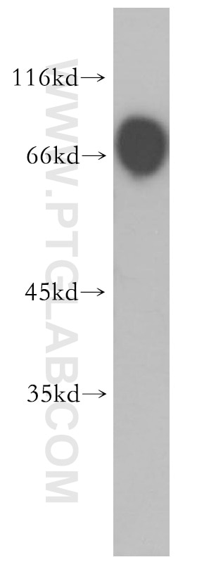 Western Blot (WB) analysis of human brain tissue using PER1 Polyclonal antibody (13463-1-AP)