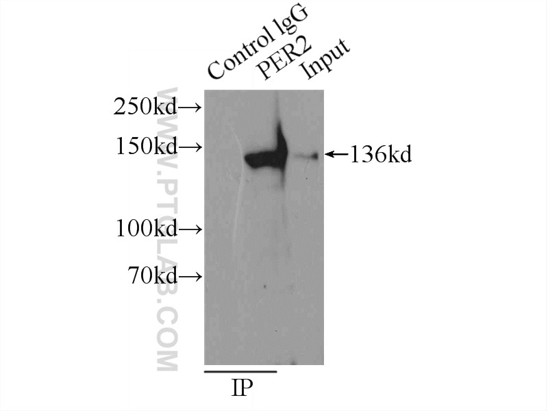 Immunoprecipitation (IP) experiment of HEK-293 cells using PER2 Polyclonal antibody (20359-1-AP)