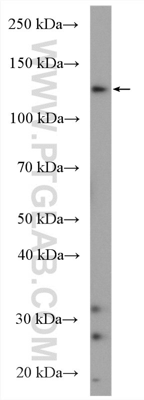 Western Blot (WB) analysis of Y79 cells using PER2 Polyclonal antibody (20359-1-AP)