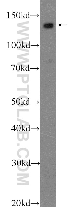 WB analysis of L02 using 20359-1-AP