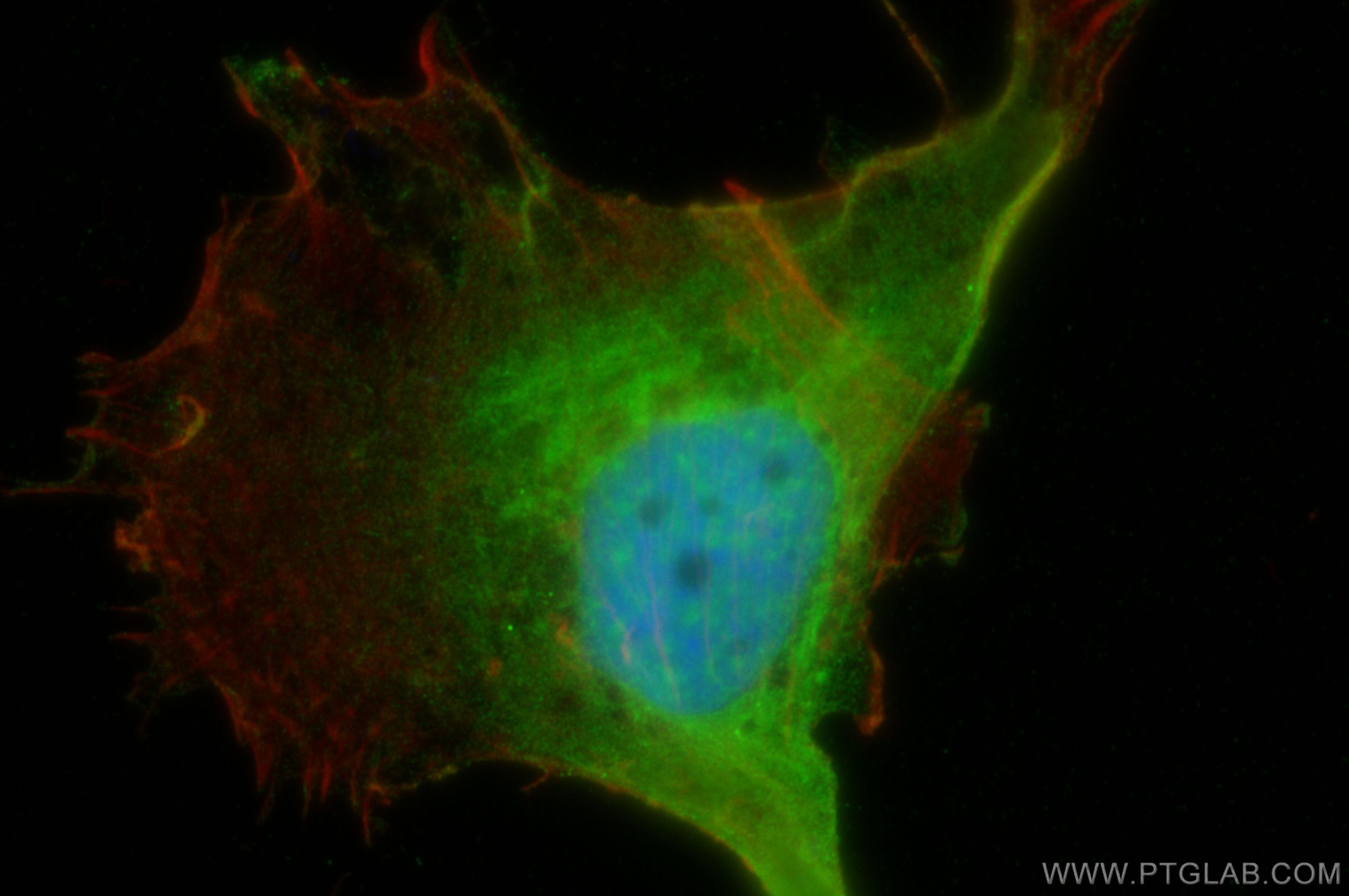Immunofluorescence (IF) / fluorescent staining of MDA-MB-231 cells using PER2 Polyclonal antibody (29954-1-AP)