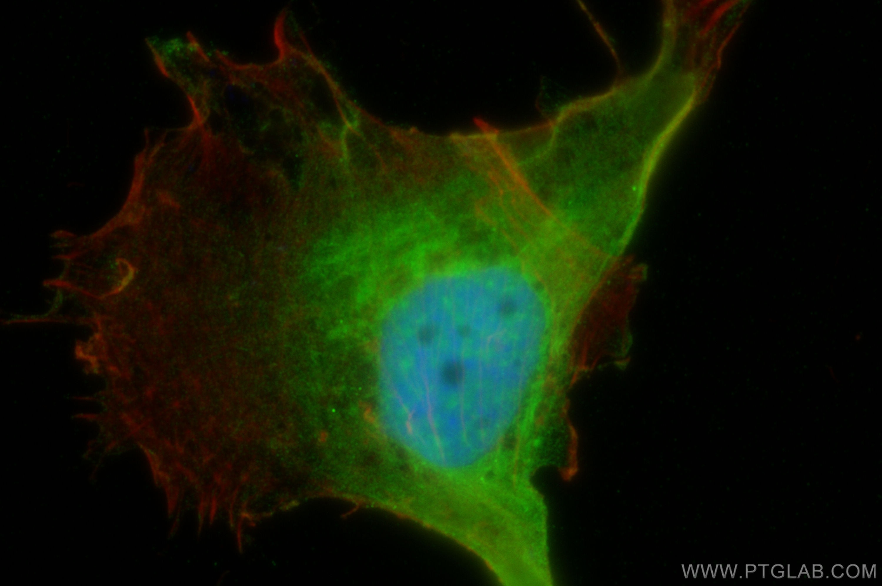 IF Staining of MDA-MB-231 using 29954-1-AP