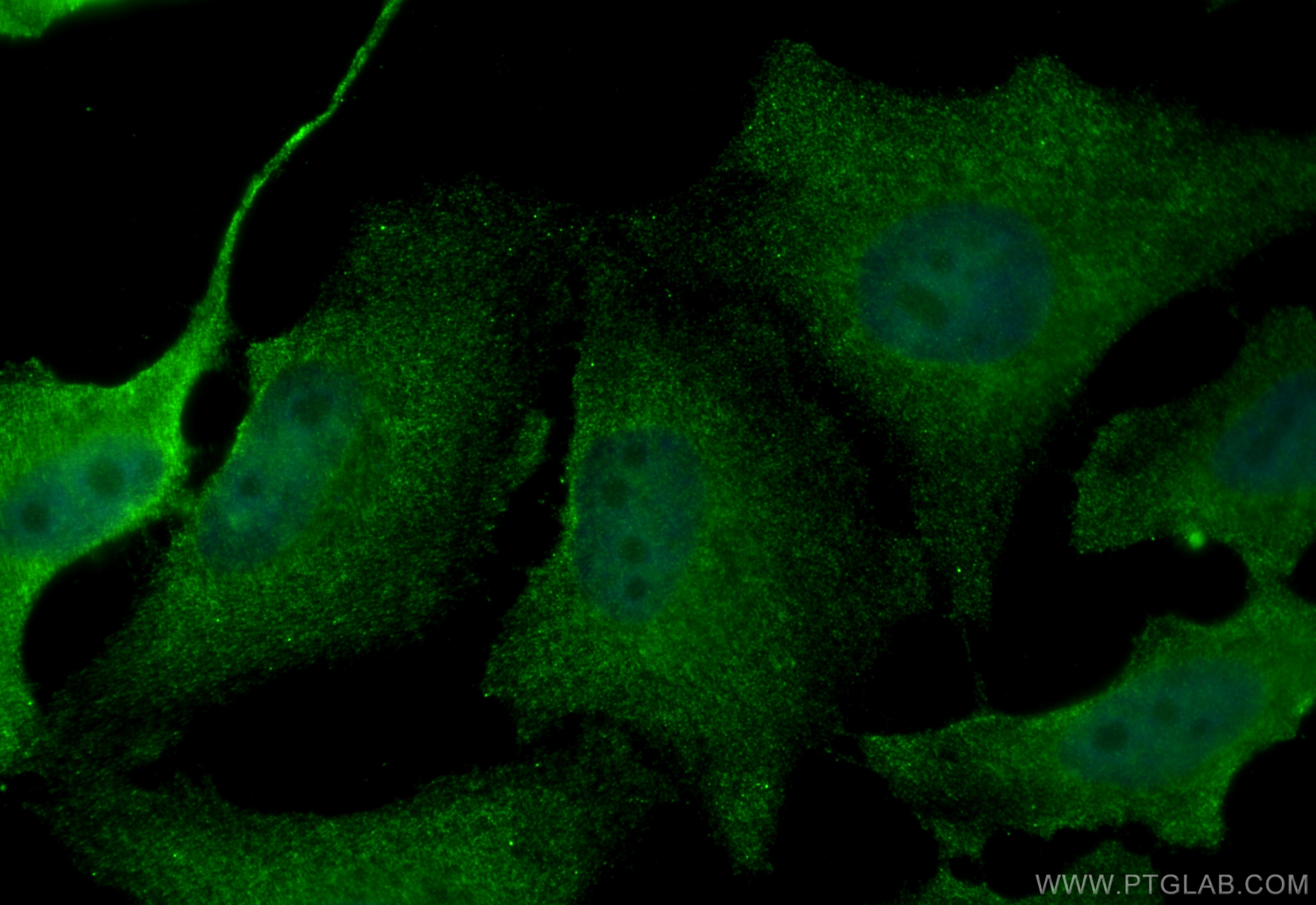 Immunofluorescence (IF) / fluorescent staining of HeLa cells using PER2 (isoform 1) Monoclonal antibody (67513-1-Ig)