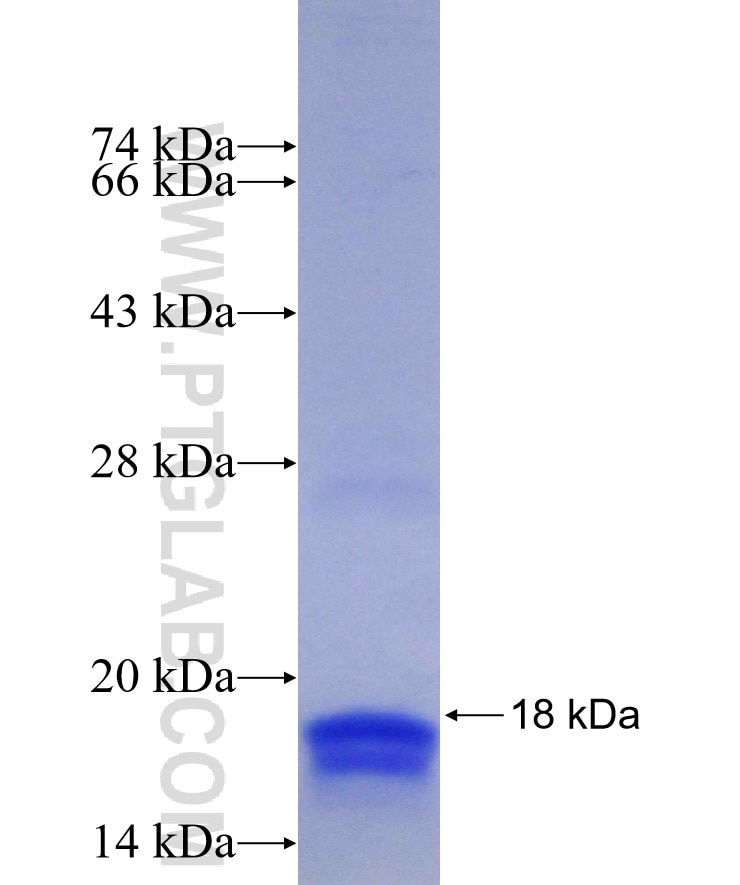 PER2 fusion protein Ag29489 SDS-PAGE