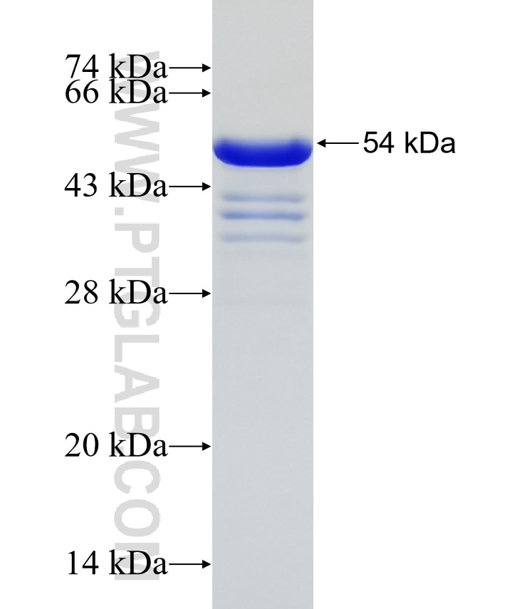 PER2 fusion protein Ag31471 SDS-PAGE