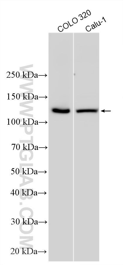 Various lysates were subjected to SDS PAGE followed by western blot with 12550-1-AP (PER3 antibody) at dilution of 1:4000 incubated at room temperature for 1.5 hours. Western Blot (WB) analysis of various lysates using PER3 Polyclonal antibody (12550-1-AP)