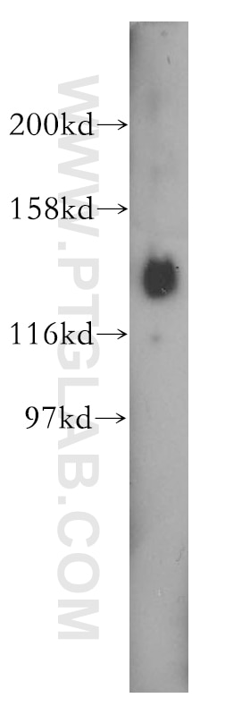Western Blot (WB) analysis of HeLa cells using PER3 Polyclonal antibody (12550-1-AP)