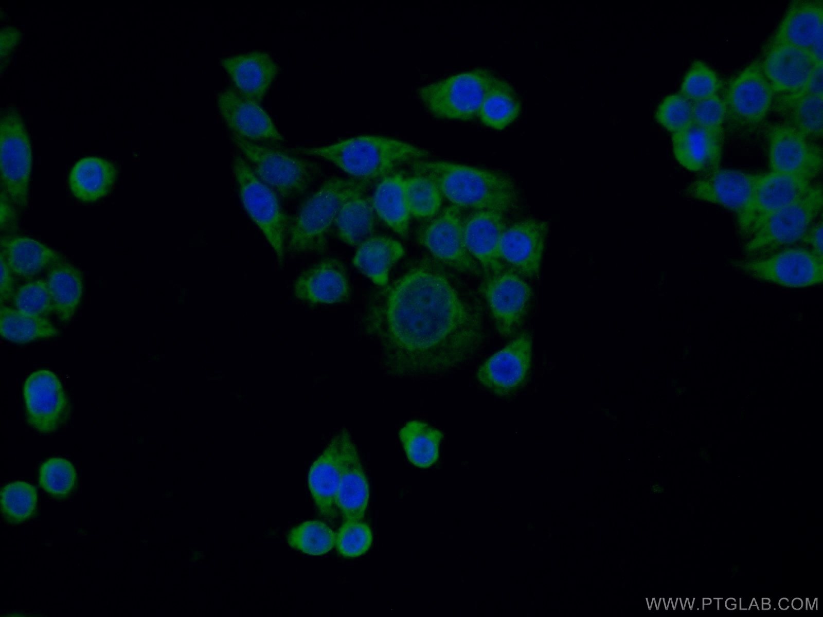 Immunofluorescence (IF) / fluorescent staining of HeLa cells using PERK/EIF2AK3 Polyclonal antibody (20582-1-AP)