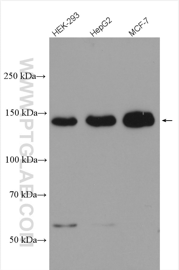 Western Blot (WB) analysis of various lysates using PERK/EIF2AK3 Polyclonal antibody (20582-1-AP)