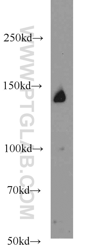 PERK/EIF2AK3 Polyclonal antibody