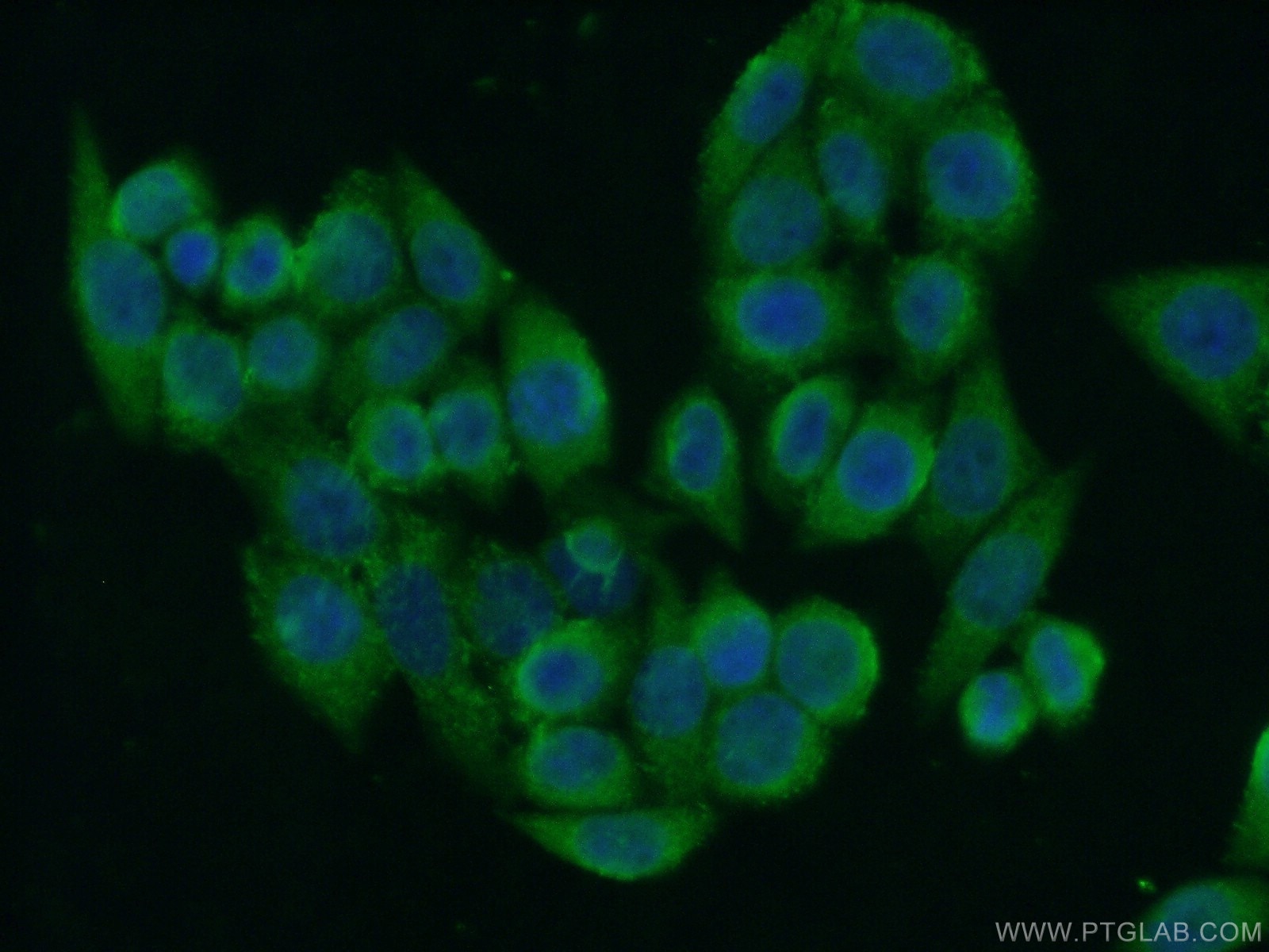 Immunofluorescence (IF) / fluorescent staining of HeLa cells using PERLD1 Polyclonal antibody (17112-1-AP)