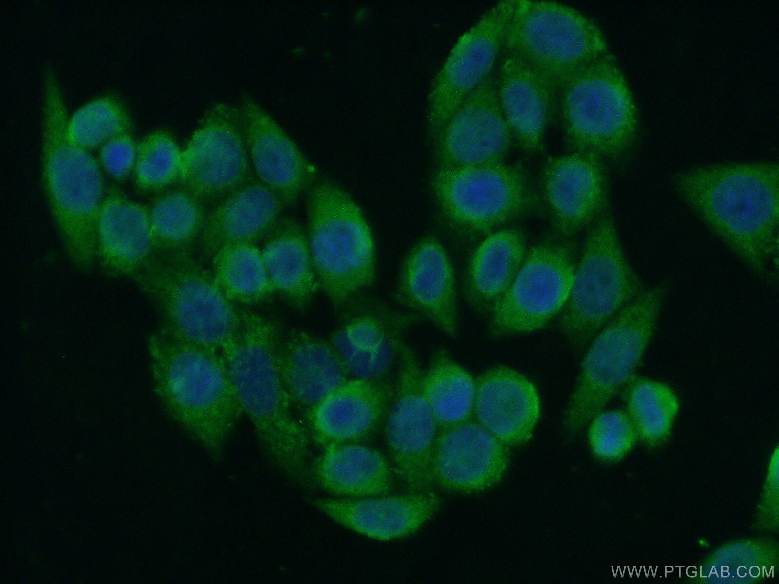 IF Staining of HeLa using 17112-1-AP