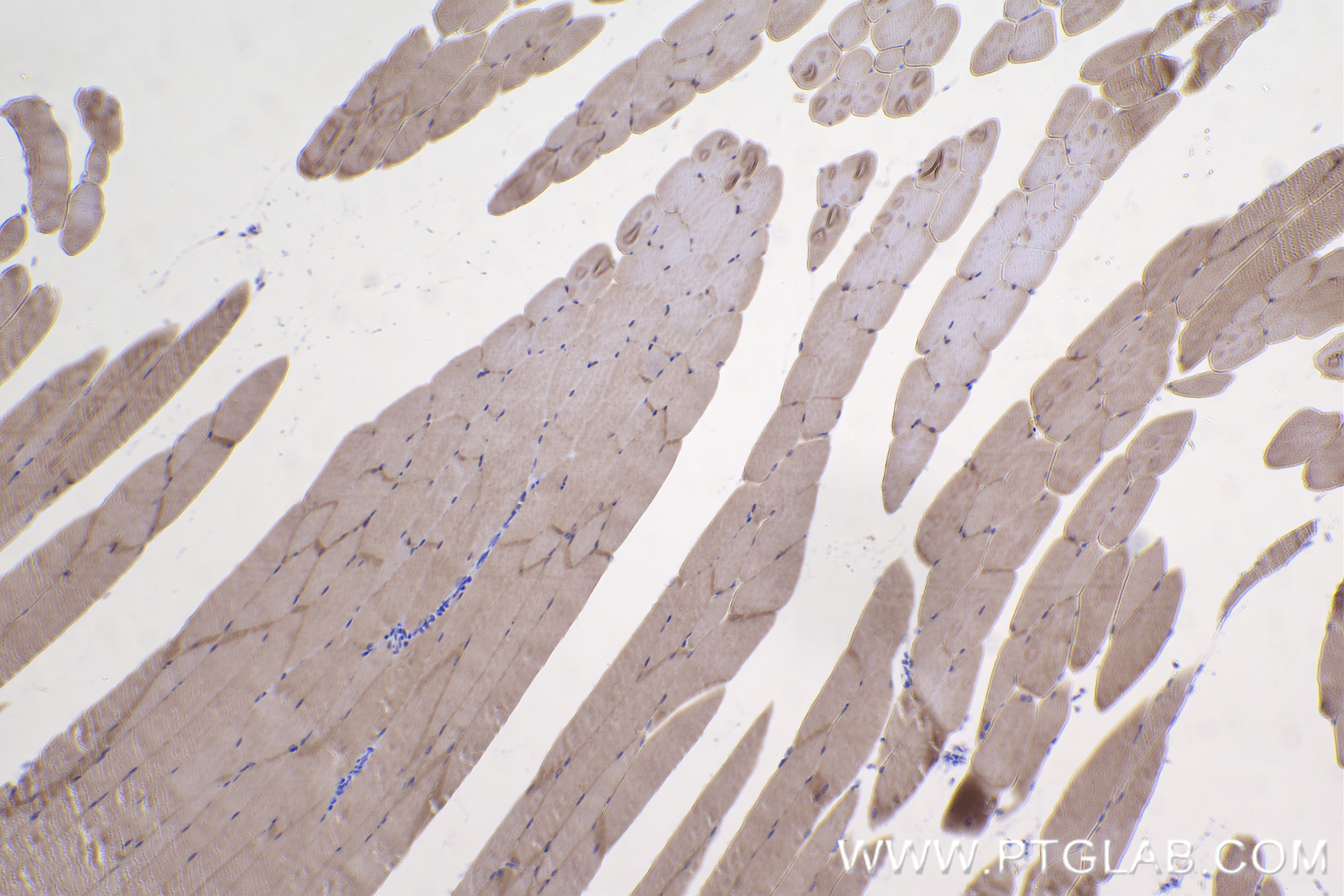 Immunohistochemistry (IHC) staining of mouse skeletal muscle tissue using PERM1 Recombinant antibody (84425-5-RR)