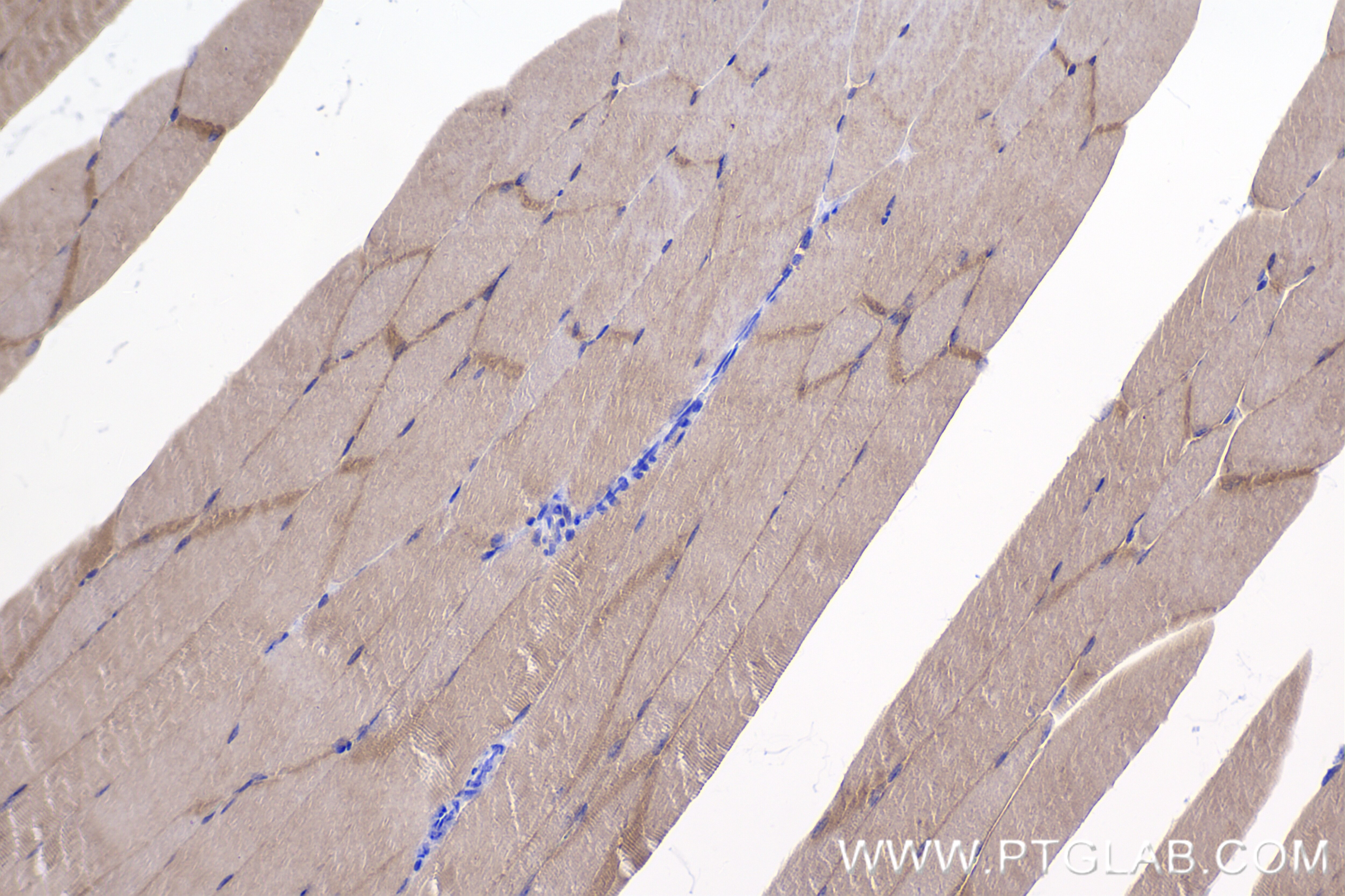 Immunohistochemistry (IHC) staining of mouse skeletal muscle tissue using PERM1 Recombinant antibody (84425-5-RR)