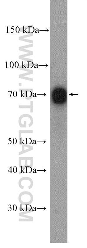 Western Blot (WB) analysis of COLO 320 cells using PES1 Polyclonal antibody (13553-1-AP)