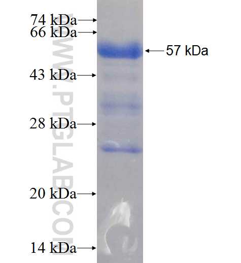 PES1 fusion protein Ag5159 SDS-PAGE