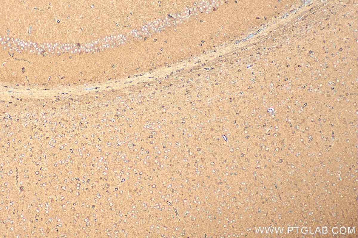 Immunohistochemistry (IHC) staining of mouse brain tissue using PET100 Polyclonal antibody (31322-1-AP)