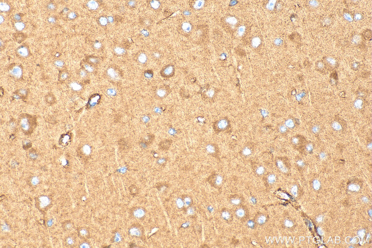 Immunohistochemistry (IHC) staining of mouse brain tissue using PET100 Polyclonal antibody (31322-1-AP)