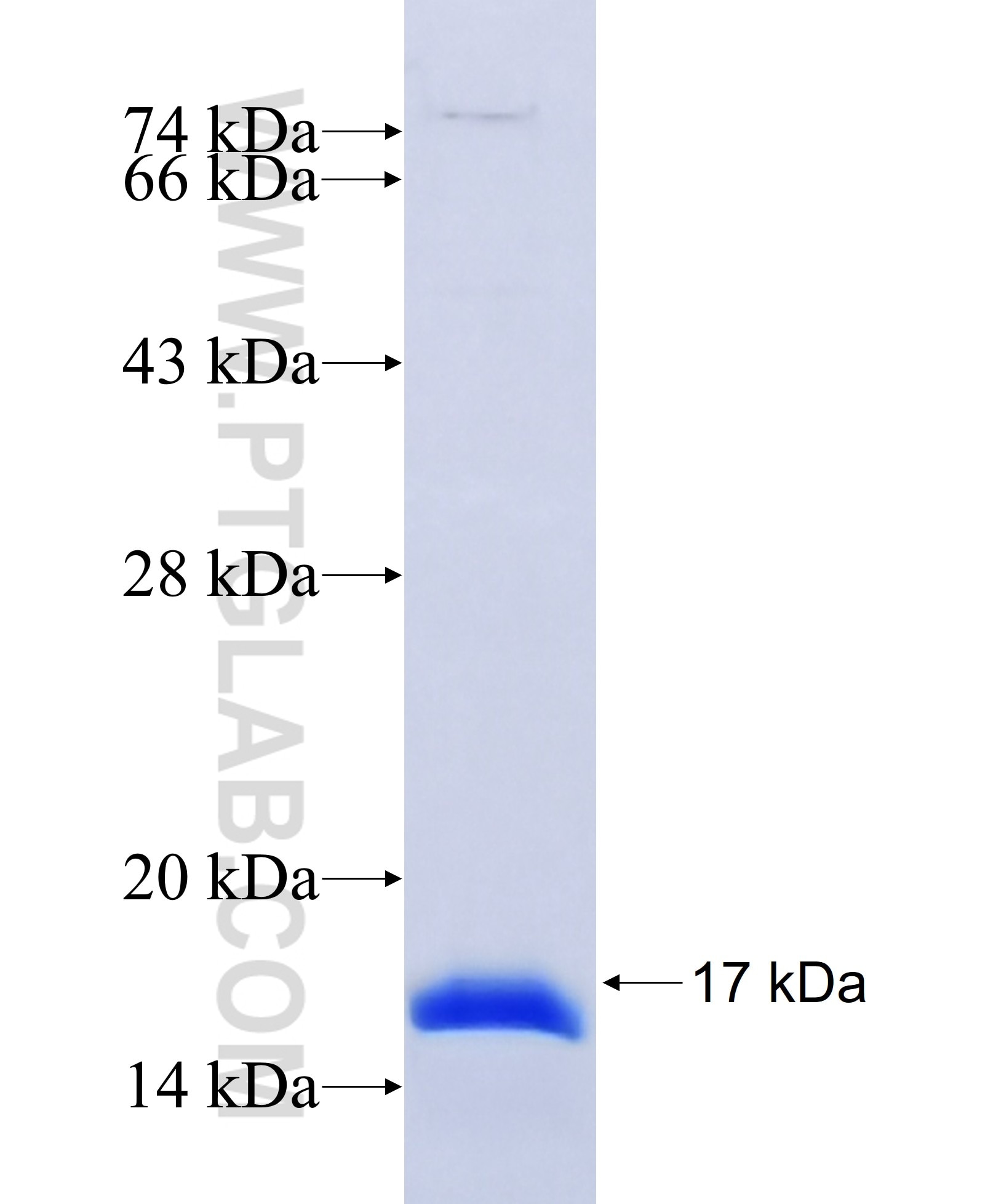 PET100 fusion protein Ag34799 SDS-PAGE PET100 fusion protein Ag34799 SDS-PAGE