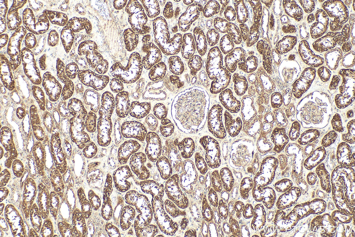Immunohistochemistry (IHC) staining of human kidney tissue using PET117 Polyclonal antibody (31066-1-AP)