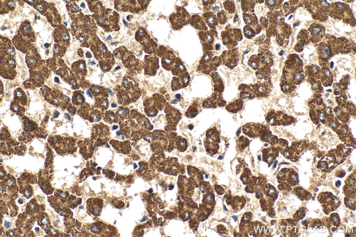 Immunohistochemistry (IHC) staining of human liver tissue using PET117 Polyclonal antibody (31066-1-AP)