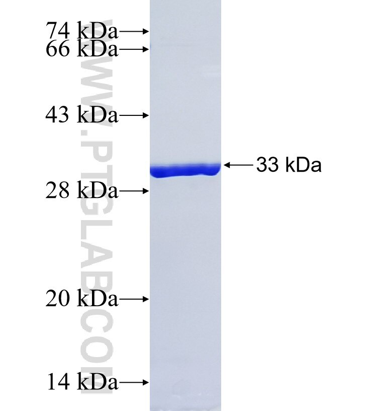 PET117 fusion protein Ag34525 SDS-PAGE