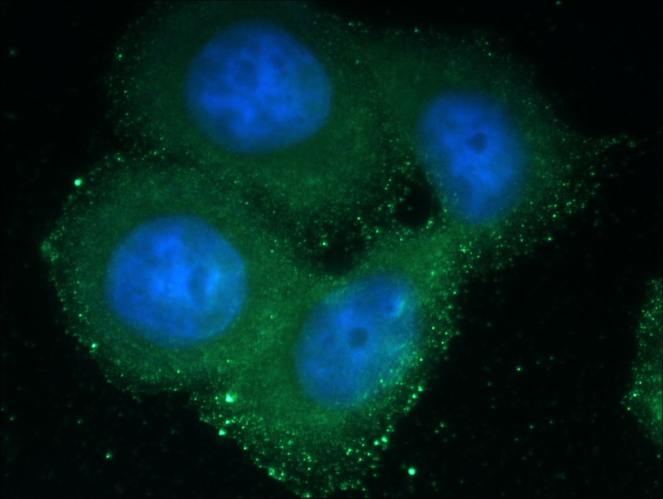 Immunofluorescence (IF) / fluorescent staining of HeLa cells using PEX1 Polyclonal antibody (13669-1-AP)