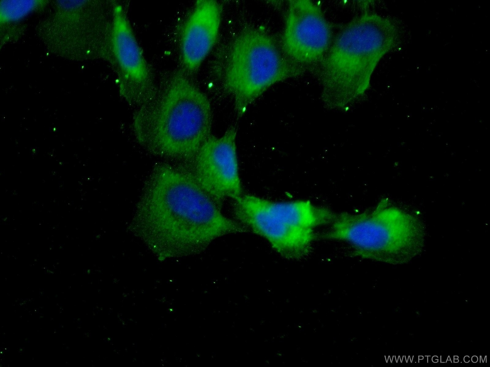Immunofluorescence (IF) / fluorescent staining of A431 cells using PEX1 Polyclonal antibody (13669-1-AP)
