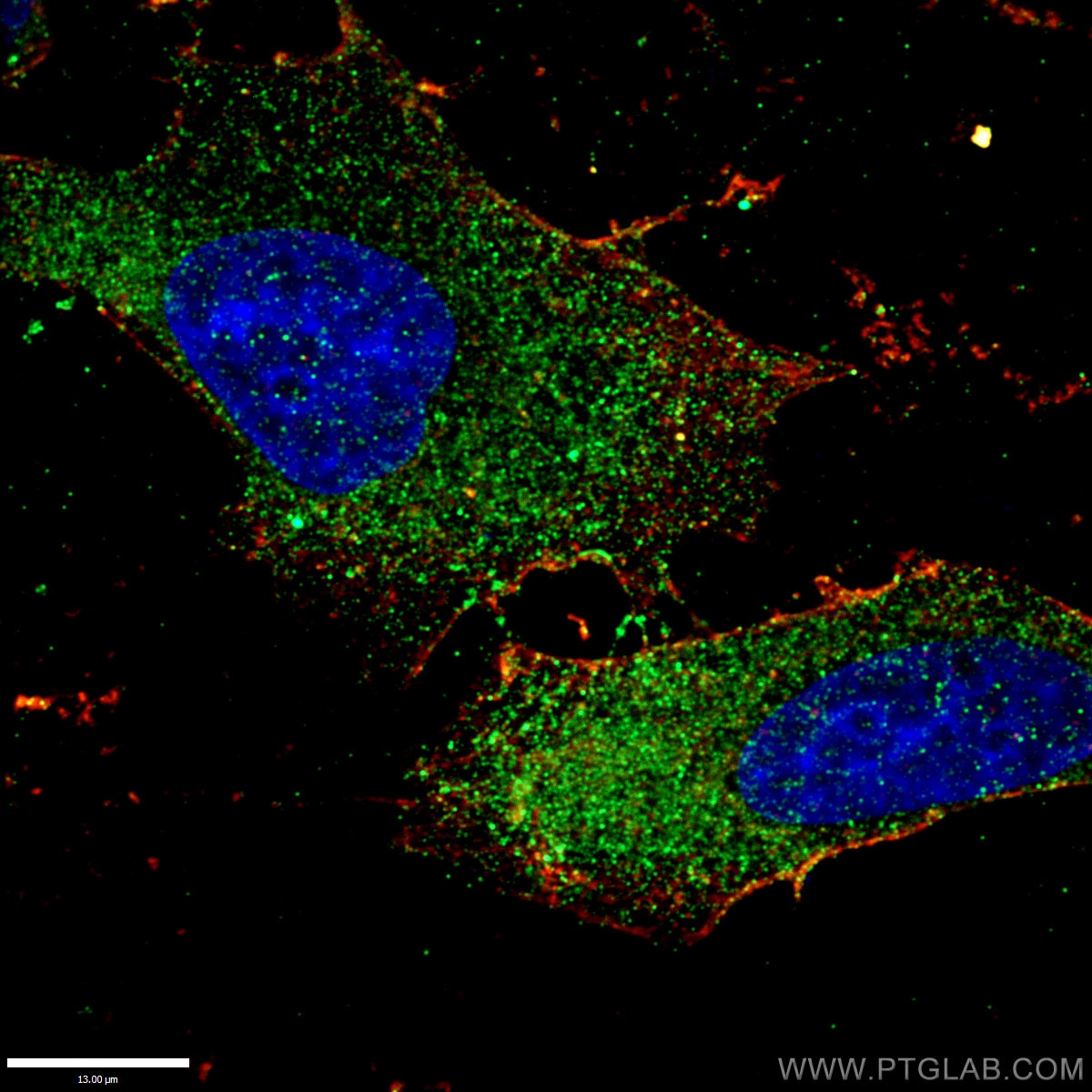 Immunofluorescence (IF) / fluorescent staining of HepG2 cells using PEX1 Polyclonal antibody (13669-1-AP)