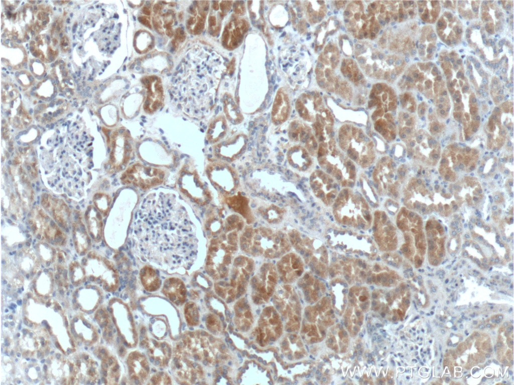 Immunohistochemistry (IHC) staining of human kidney tissue using PEX1 Polyclonal antibody (13669-1-AP)