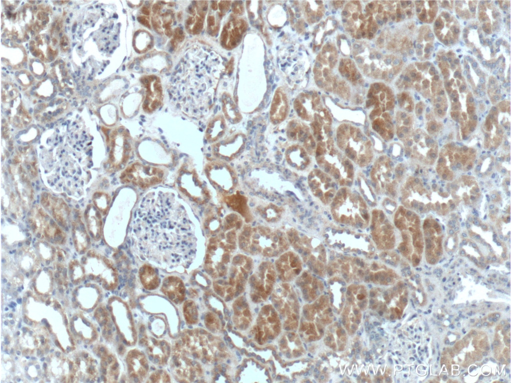 IHC staining of human kidney using 13669-1-AP