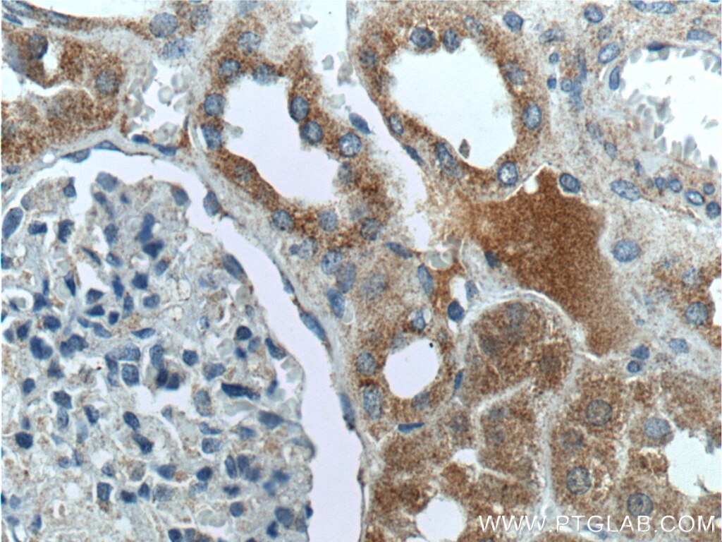 Immunohistochemistry (IHC) staining of human kidney tissue using PEX1 Polyclonal antibody (13669-1-AP)