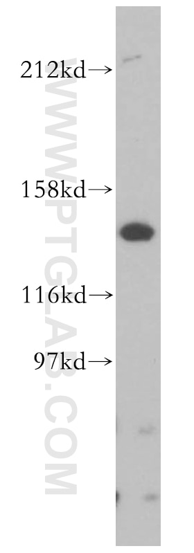 Western Blot (WB) analysis of Jurkat cells using PEX1 Polyclonal antibody (13669-1-AP)