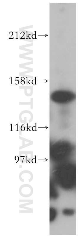 Western Blot (WB) analysis of HeLa cells using PEX1 Polyclonal antibody (13669-1-AP)